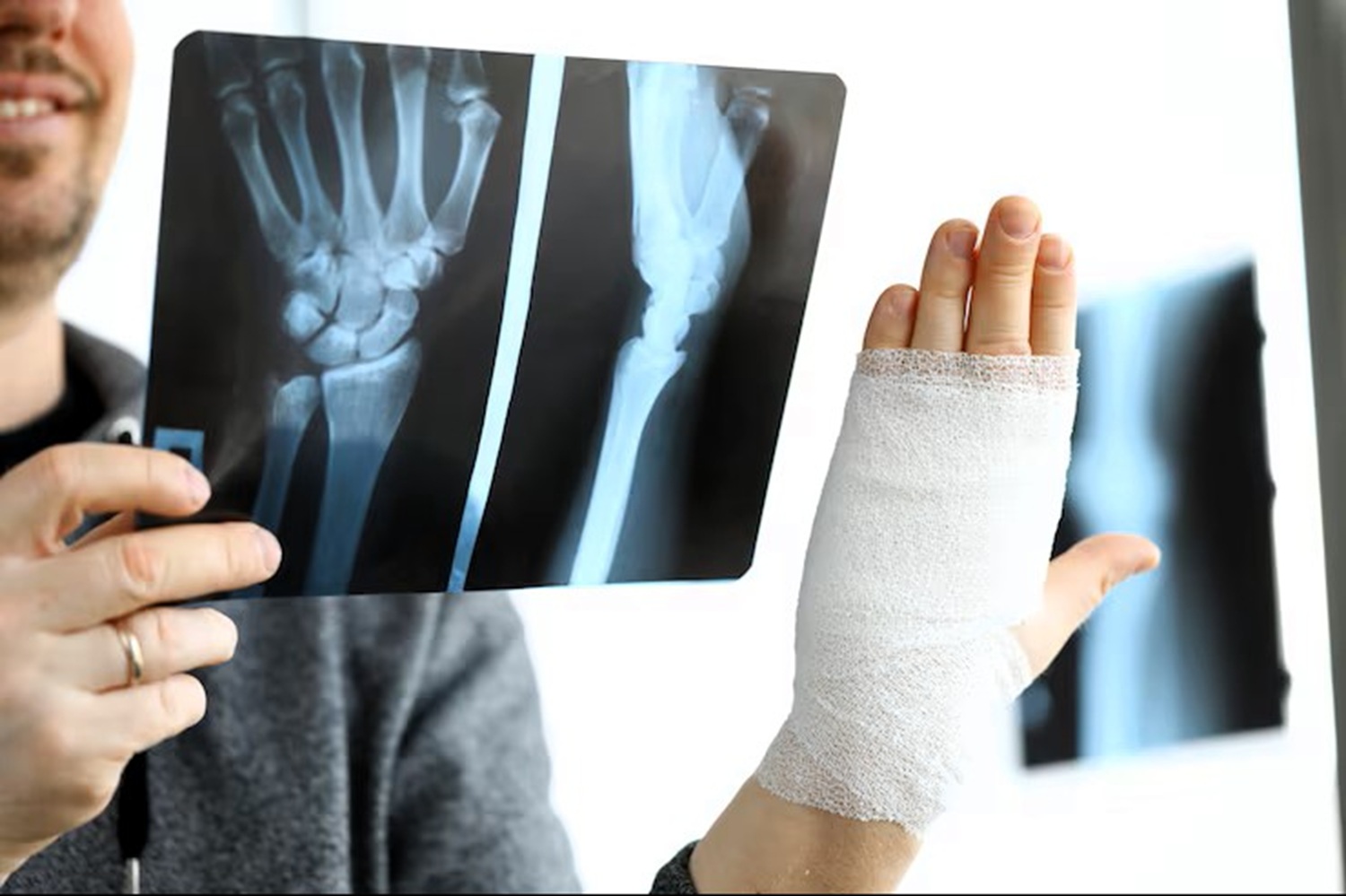 BONES 02": “El pegamento chino que revoluciona la reparación de fracturas óseas en 180 segundos”.